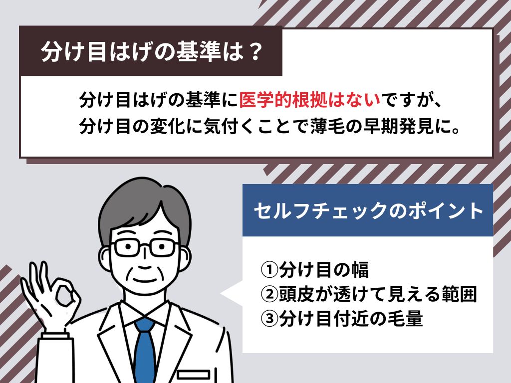 分け目はげの基準はどこから？セルフチェック