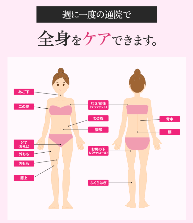 BSクリニックの医療ダイエットの通い方
