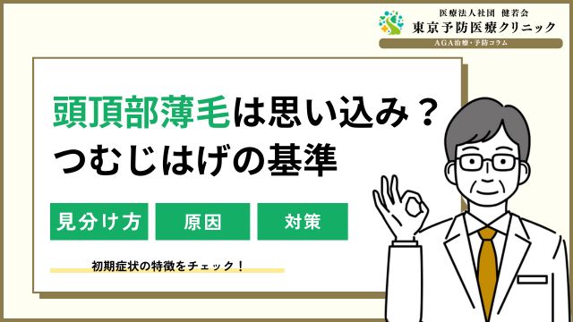 頭頂部薄毛（つむじはげ）は思い込み？基準はどこから？