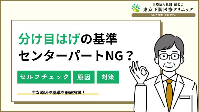 分け目はげの基準とは？センターパートやAGAなどの原因を解説