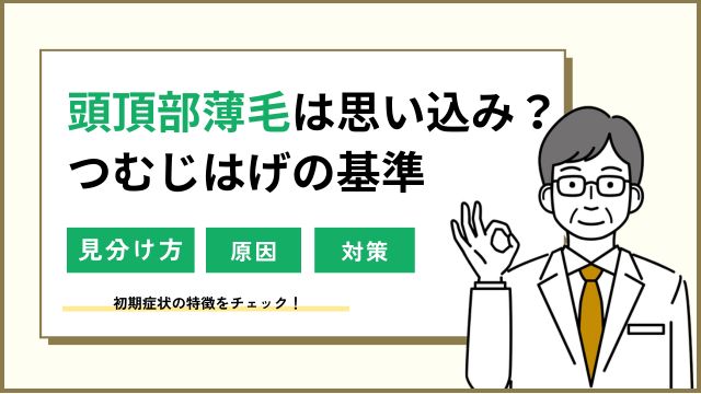 頭頂部薄毛（つむじはげ）は思い込み？基準はどこから？