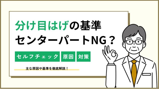 分け目はげの基準とは？センターパートやAGAなどの原因を解説